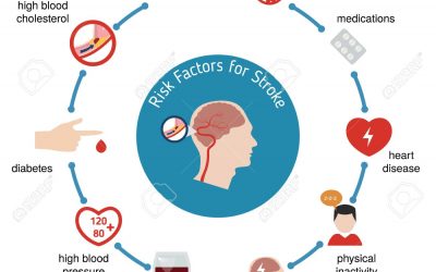Are you at risk for a stroke?